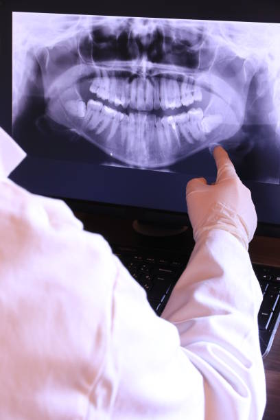 Best Emergency Denture Repair in Zionsville, IN